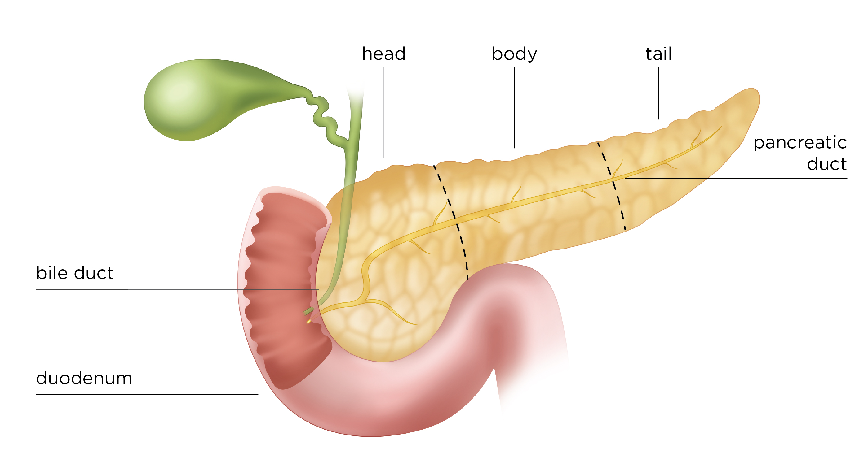 Las partes del páncreas son: cabeza, cuerpo, cola, ducto pancreático, ducto biliar.